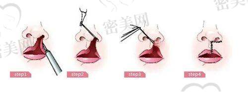 关于术前-术后:王栋医生的服务流程如何?