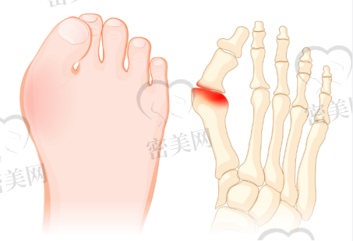 清远韩美医疗美容门诊部富贵包手术收费标准及价目表