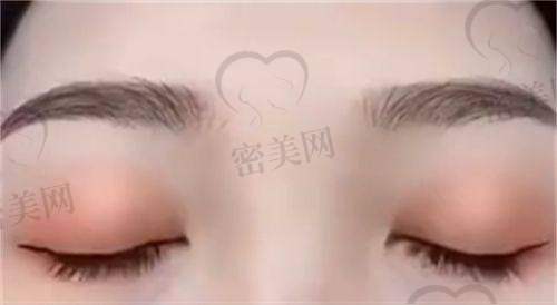 杭州连天美医疗美容医院:脂肪塑形名不虚传