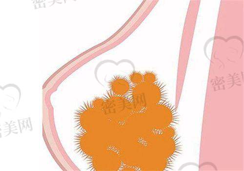 “馒化脸”的真实图片分析