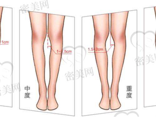 六、部分整形项目价格参考