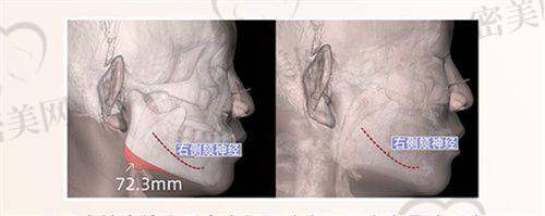 青岛亿嘉琏医疗美容诊所——专注眼部整形与吸脂塑形