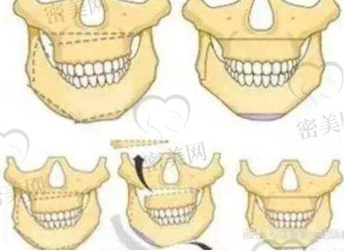 防城港华美医疗美容门诊部服务口碑怎么样?患者真实反馈