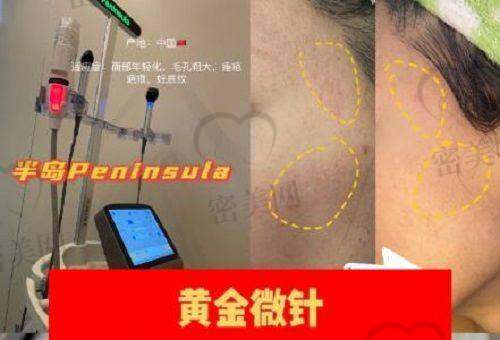 医生技术不过关