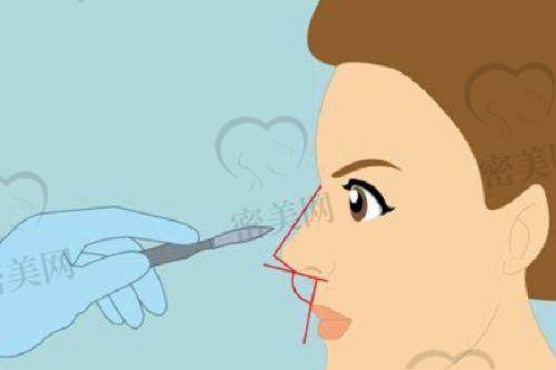 清远韩美医疗美容门诊部价格表: