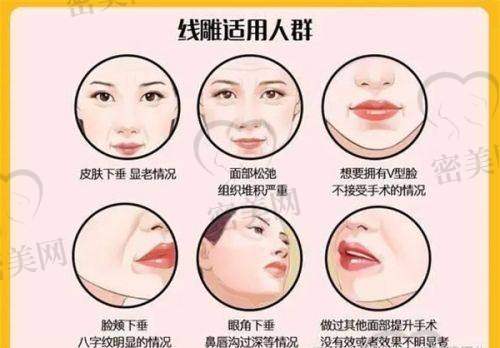 杭州星辰医疗美容:眼部整形“修复圣手”