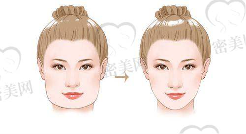 深圳瑞芙臣医疗美容门诊部地址及乘车路线: