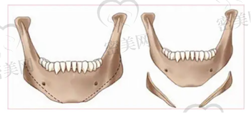 深圳瑞芙臣医疗美容门诊部特色项目: