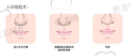 第一次做?这几招选择优质医院和医生特别关键