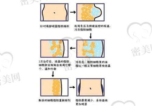 防城港华美医疗美容收费贵不贵?有没有套餐优惠?