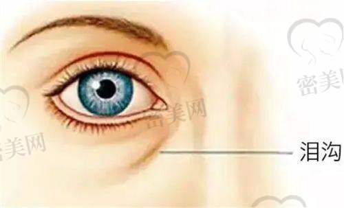 三、脂肪填充馒化脸的修复方法