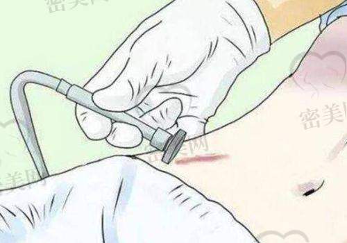 “馒化脸”的修复方法