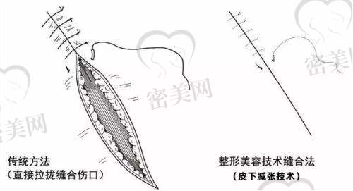 广州伊美医疗美容门诊部:仪器更新频率高、医生风格独立