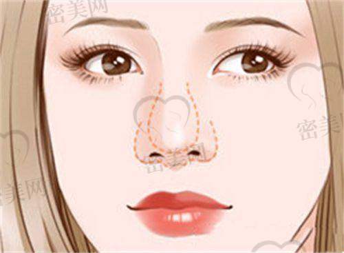 韩美患者口碑反映:术后体验与修复成效到底怎样?