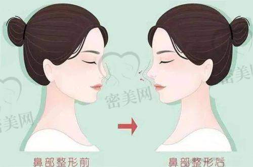 济南华韩整形收费情况