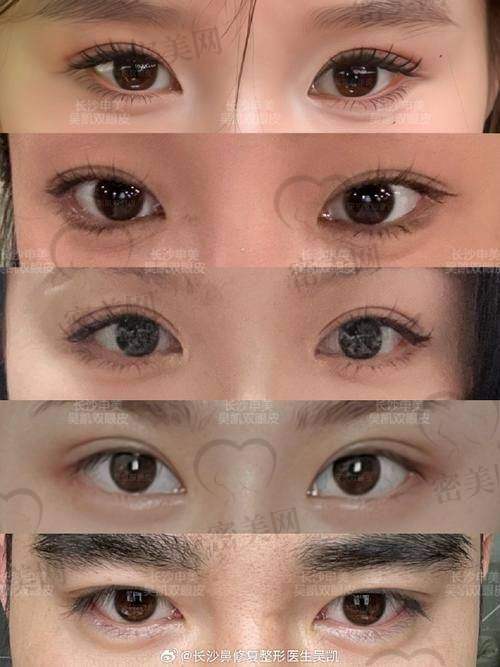 温州艺星——林文君医生:网红风、混血风偏好者的优选