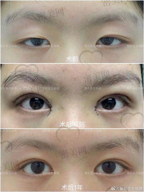 7. 广州妍熙整形美容门诊部(张红艳)