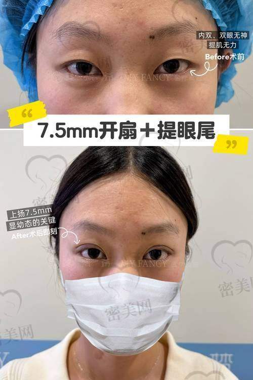 初见蔡灵医生:专精又亲切