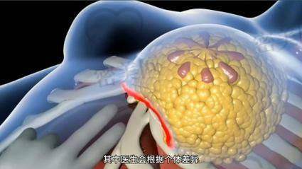 珠海中大五院术后管理是否贴心?