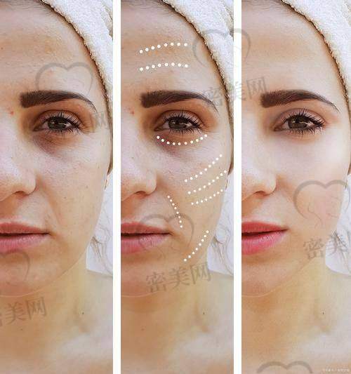 为什么越来越多人选择聂云飞医生做面部提升?