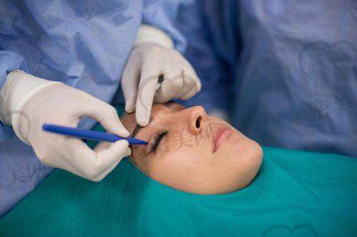 成都杨迪医生是谁?为什么他做眼周筋膜提升这么有名?