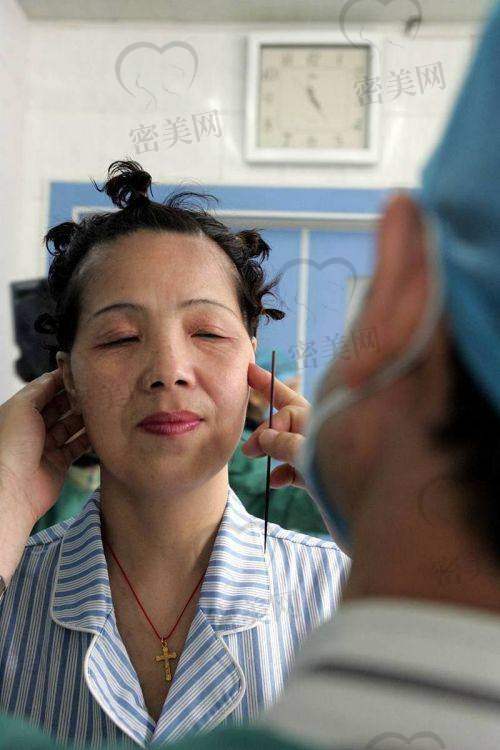 沈阳名流王松做拉皮手术的真实反馈怎么样?