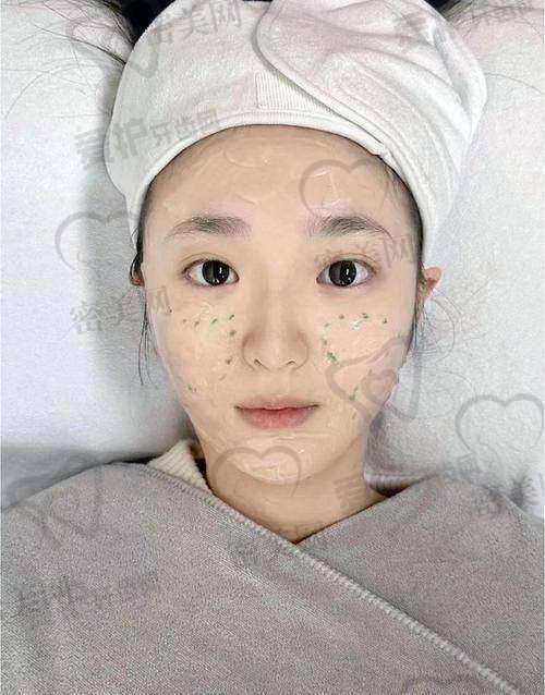 激光美容项目成效表对照:不同类型项目怎么选?