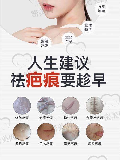 沈阳皇姑华美疤痕修复中 心:正规医院定价,明码标价透明放心