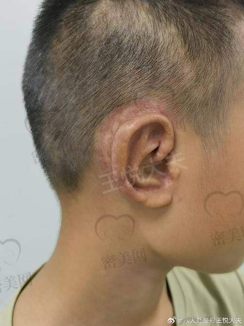现场真实患者实例分享:来自广西、湖南、江西的家长反馈