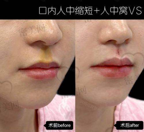 真人实例反馈:真实体验才是王道!