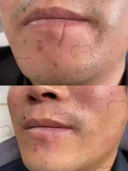 靠谱吗?患者真实评分反馈如何?