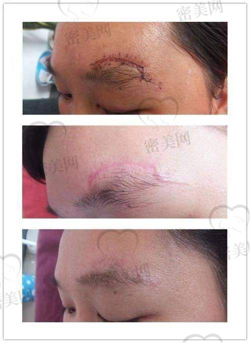 沈阳华美就诊提醒:预约、流程及费用支付