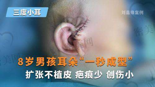 家长必看建议:选择合适医生不仅要技术,更要“真诚负责”