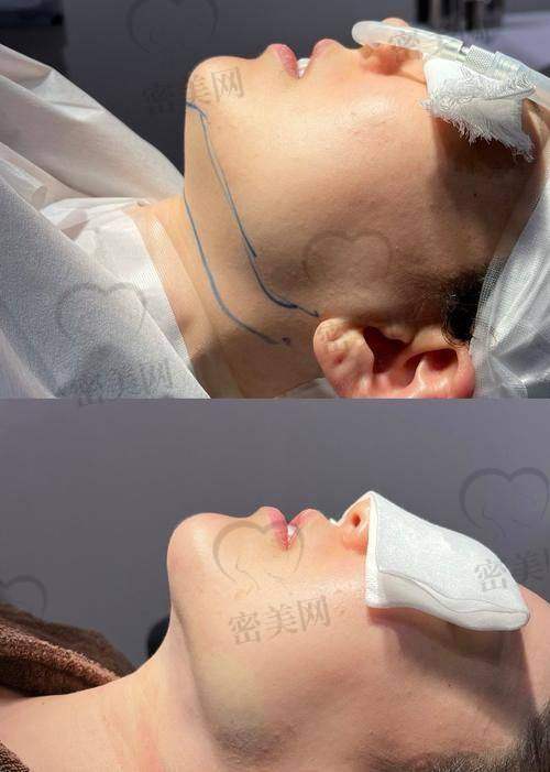 深圳米兰柏羽医疗美容:钟伟洪医生