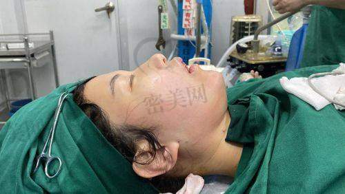 深圳今喜医疗美容:曹孟君医生