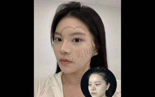 深圳春熙星辰医疗美容:周泽医生