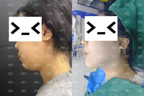 深圳艺美医疗美容:王云飞医生