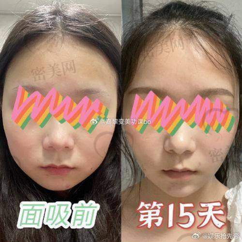 深圳八大处医疗美容医院:黄奔医生