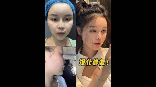 深圳优理肤医疗美容:唐墨医生