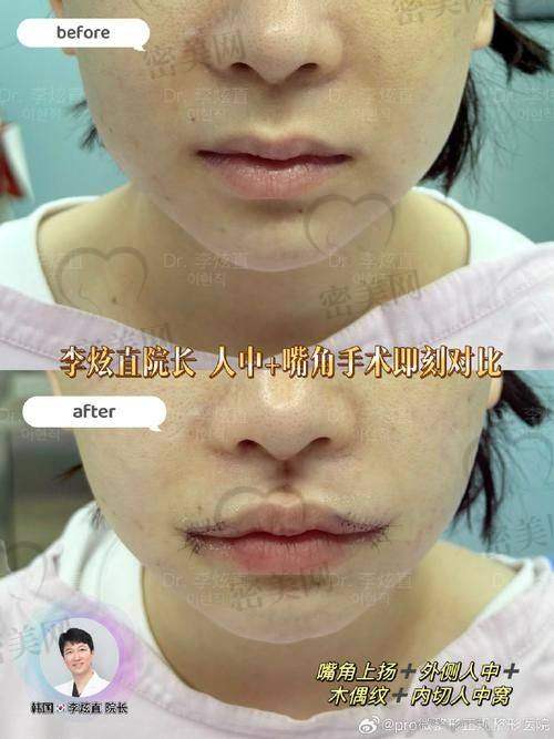 补贴小道消息!如何预约胡俊杰还省下一笔?