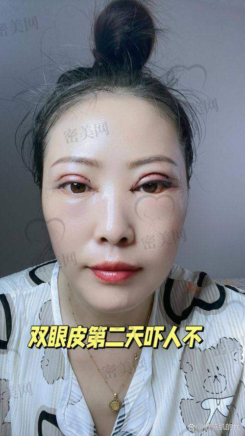 广州双眼皮修复热门医院+医生榜单一览
