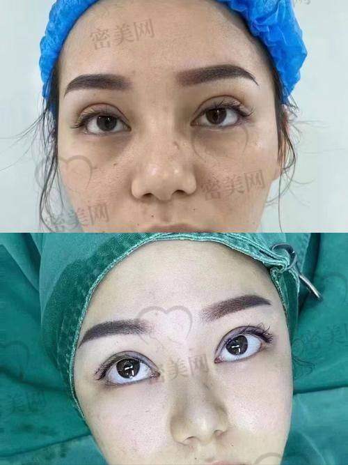 2. 广州艺星医疗美容医院(项美莲)