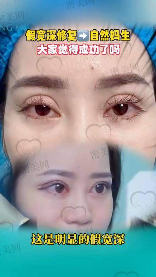 温州艺星——黄乐医生:擅长自然派眼综合,口碑好评多