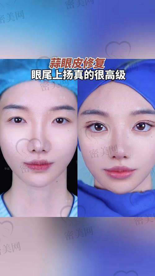 1. 广州美莱医疗美容医院(黄泽春)