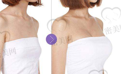 上海九院激光祛斑实用攻略与真实费用