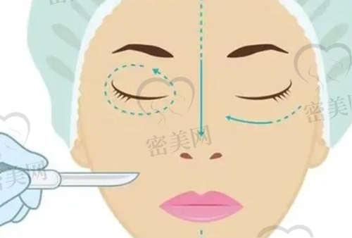 谭敏峰医生鼻眼整形价格公开(2025年全新)