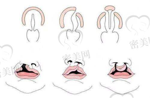 5、上海彩虹医疗美容