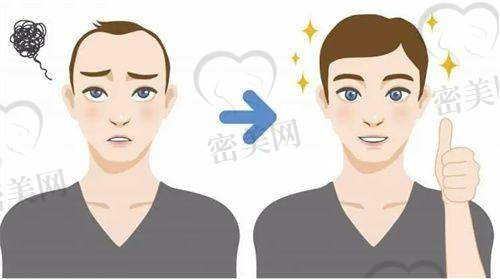 福州大麦微针植发门诊:植发笔同步种植,美感自然不翻车