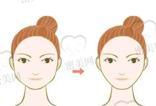 谁更适合去上海雍禾植发?避坑建议来了!