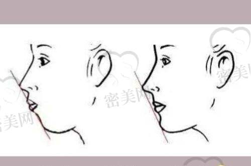 热议医生介绍:杨宇梓医生,专注高难度整形修复